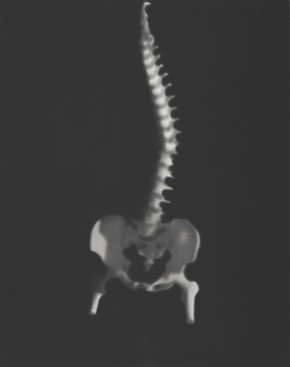 Spine, from Series 5